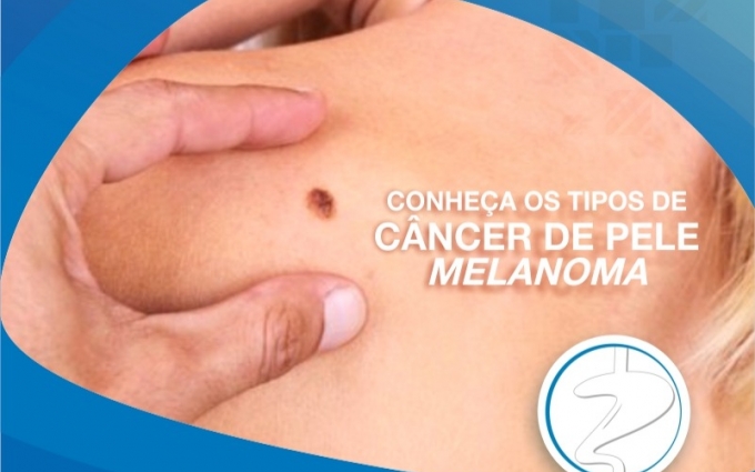 Conheça os tipos de câncer de pele melanoma e não melanoma