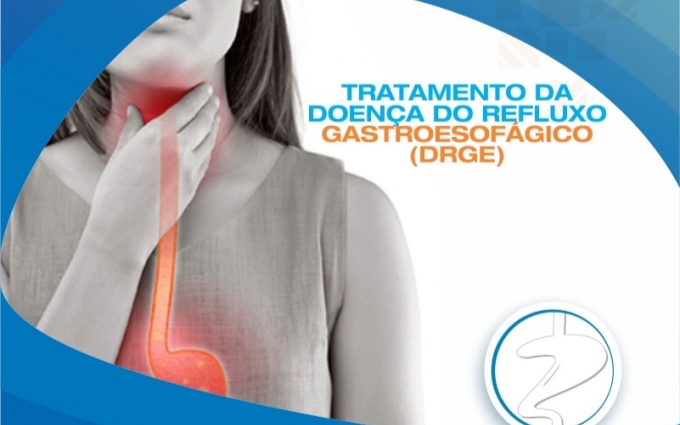 Tratamento da Doença Do Refluxo Gastroesofágico (DRGE)