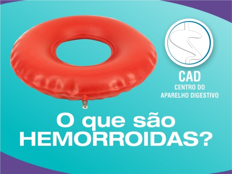 Como Tratar As Hemorroidas? | CAD Dr. Zardo